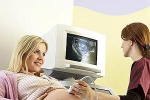 Шевеление плода при беременности: норма, на каком сроке, частые, сильные Должен шевелиться малыш
